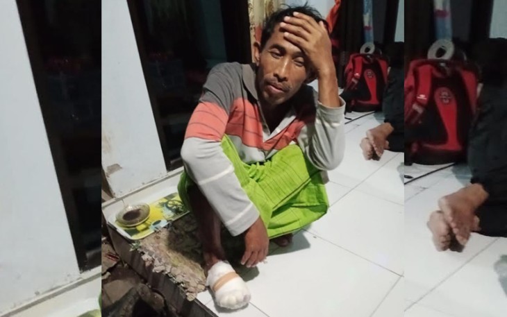 Kaki kanan Khori Anam (55) nampak dibalut dengan perban.