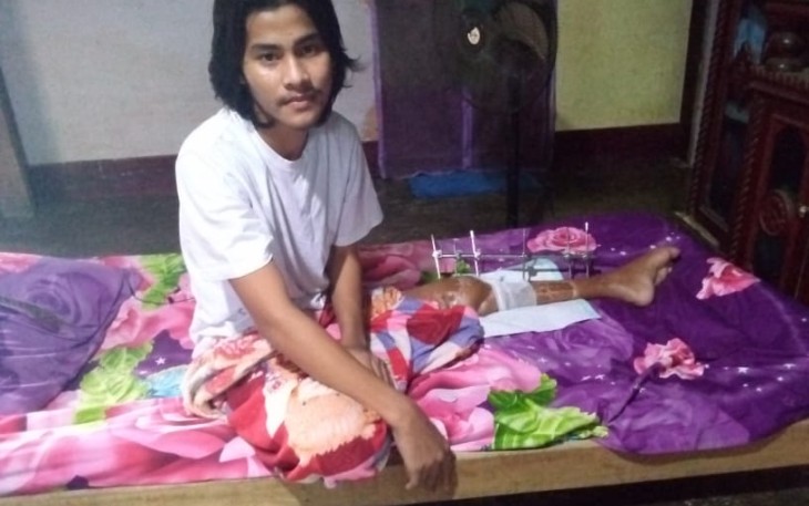 Remaja (20) warga Desa Seuneubok Rambong, Dusun Blang Mee, Kecamatan Idi Rayeuk, Kabupaten Aceh Timur membutuhkan uluran tangan dermawan untuk biaya perjalan selama berobat ke Banda Aceh. 