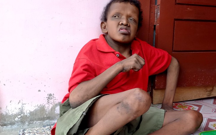 Zulfikar (33) (Penyadang Disabilitas), Warga Dusun TM. Zein, Desa Gampong Aceh, Kecamatan Idi Rayeuk, Aceh Timur