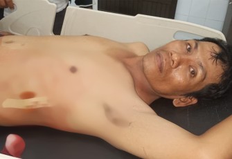 Korban usai mendapat perawatan medis di Rumah Sakit Umum HAMS Kisaran
