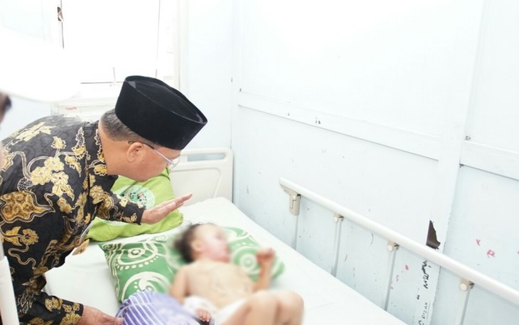 Gubernur Bengkulu Rohidin Mersyah Mengunjungi Balita Nadifa Korban Tersiram Minyak Goreng Panas di RSUD M Yunus 