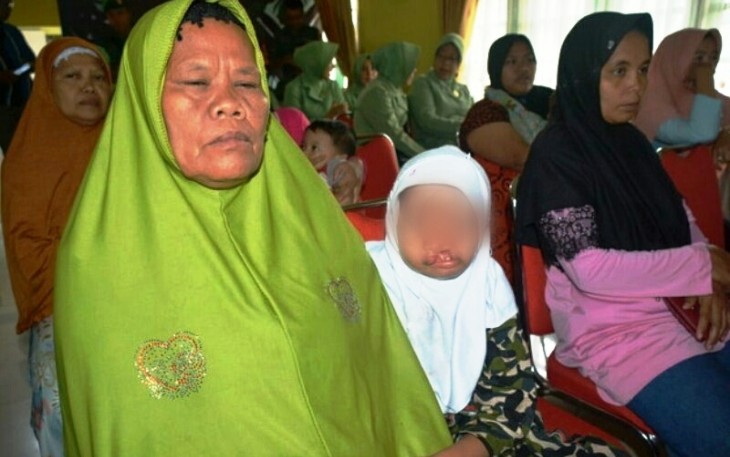 Operasi Bibir Sumbing Hari Juang TNI AD