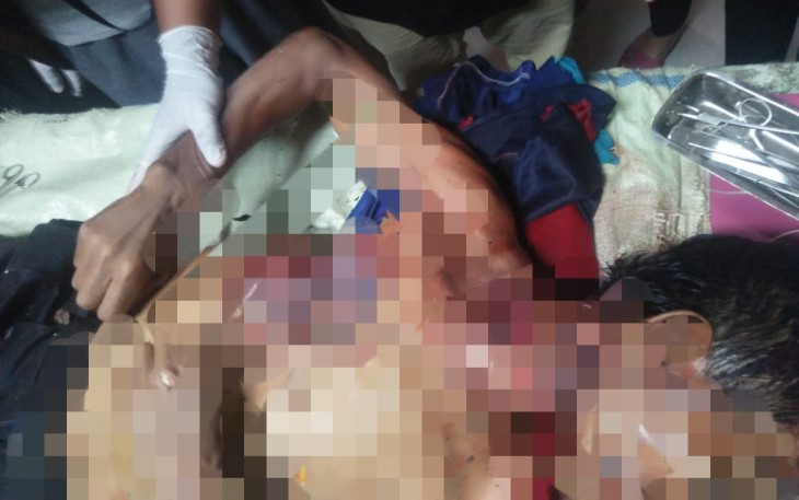 Jenazah korban saat dibawa ke Puskesmas