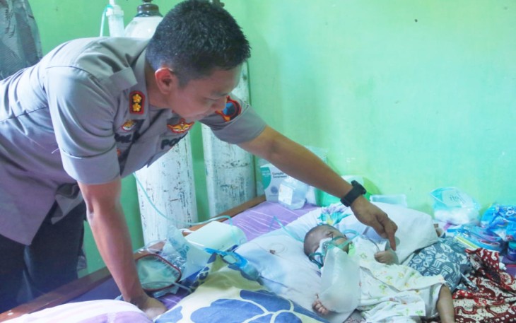 Kapolres Batang saat menjenguk Bayi Penderita Jantung Bocor