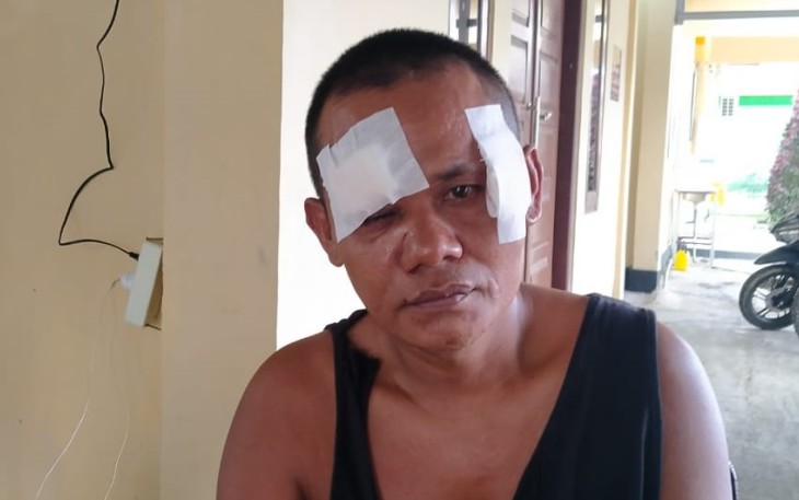 kondisi korban saat melapor ke Polisi