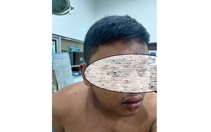 Terduga Pelaku Diamankan        