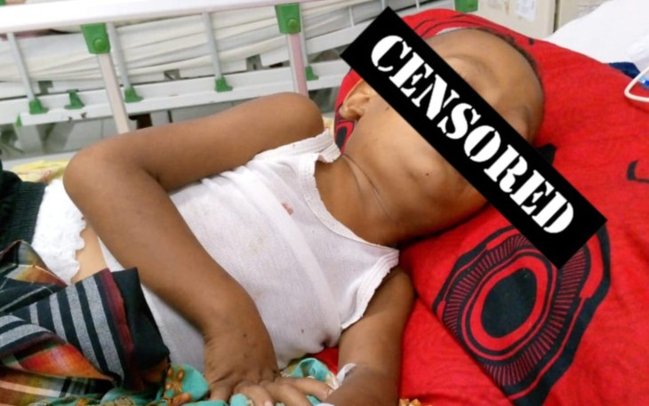 Al Karim Bocah 4 Tahun di Aceh Timur Didera Penyakit Bertubi-tubi