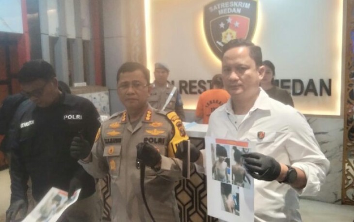 Kapoltrstabes Medan Ungkap Motif Seorang Ibu Menganiaya Anak di Medan yang Viral