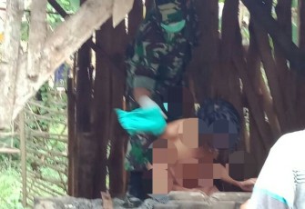 Demi kemanusiaan "Z" dievakuasi dari pasungan