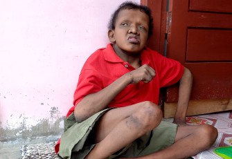 Zulfikar (33) (Penyadang Disabilitas), Warga Dusun TM. Zein, Desa Gampong Aceh, Kecamatan Idi Rayeuk, Aceh Timur